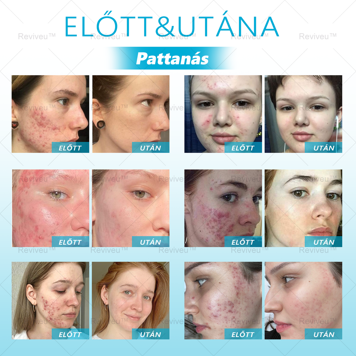 💎💎Gratulálunk, hogy te is az első 200 rendelés egyikévé váltál! Élvezd az extra 50% kedvezményt! Cselekedj most, és mutasd meg szép arcodat. Ha most lemaradsz, csak jövőre lesz újabb lehetőség!