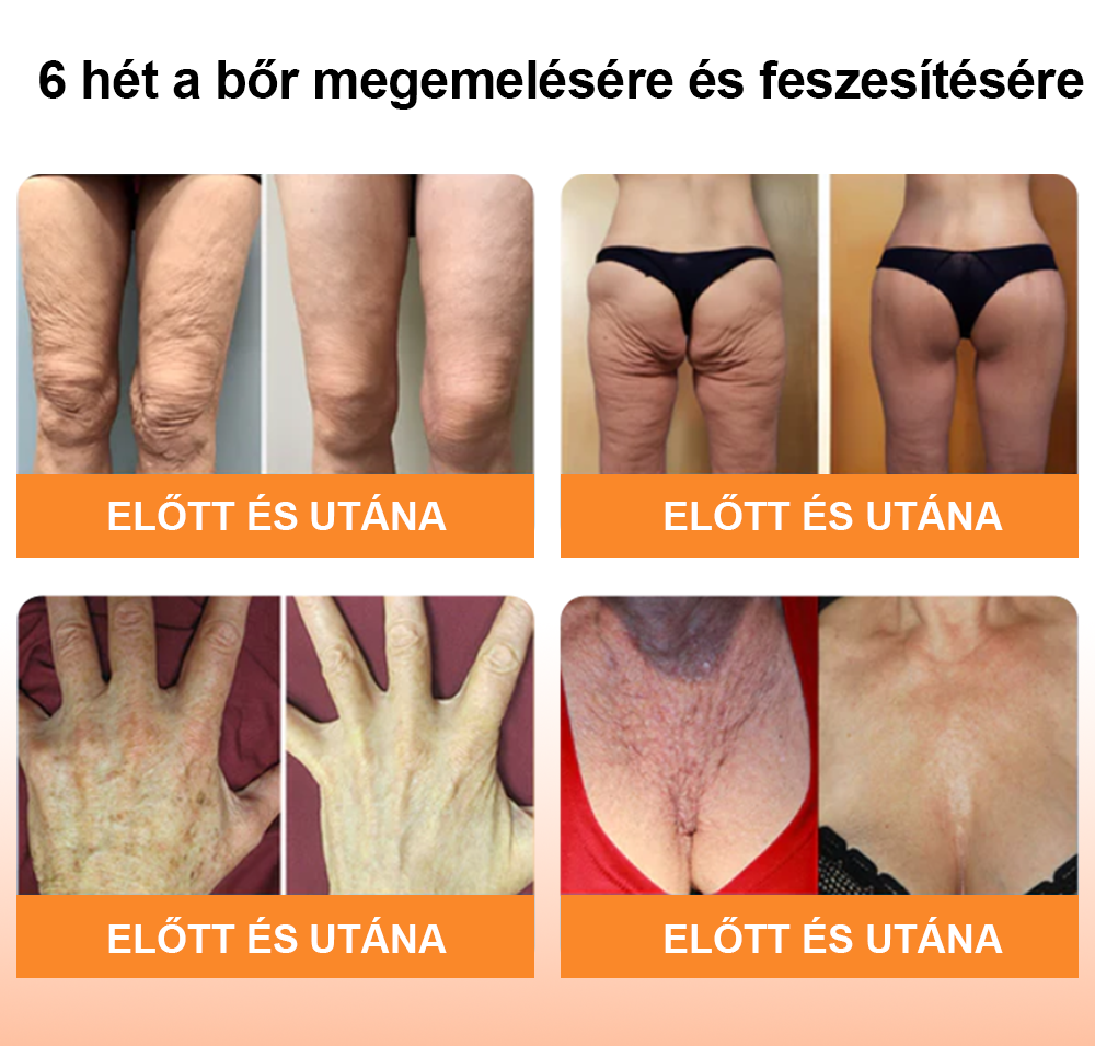 đăHivatalos MĂĄrkaboltăFiatalBĆrâą PrĂ©mium FeszesĂtĆ RĂĄnctalanĂtĂł SzĂ©rum ïŒâRĂĄncok Ă©s lazasĂĄg eltĂŒntetĂ©se âBĆr rugalmassĂĄgĂĄnak helyreĂĄllĂtĂĄsaïŒ