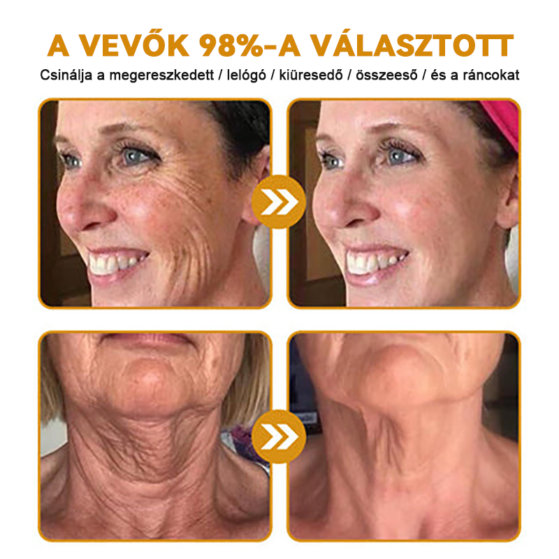 ⚜️⚜️⚜️【Hivatalos Márkabolt】FrissArc™ Botox Méhméreg Ránctalanító Krém