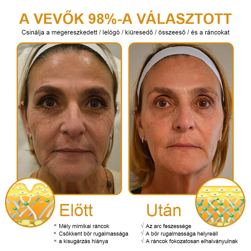⚜️⚜️⚜️【Hivatalos Márkabolt】FrissArc™ Botox Méhméreg Ránctalanító Krém