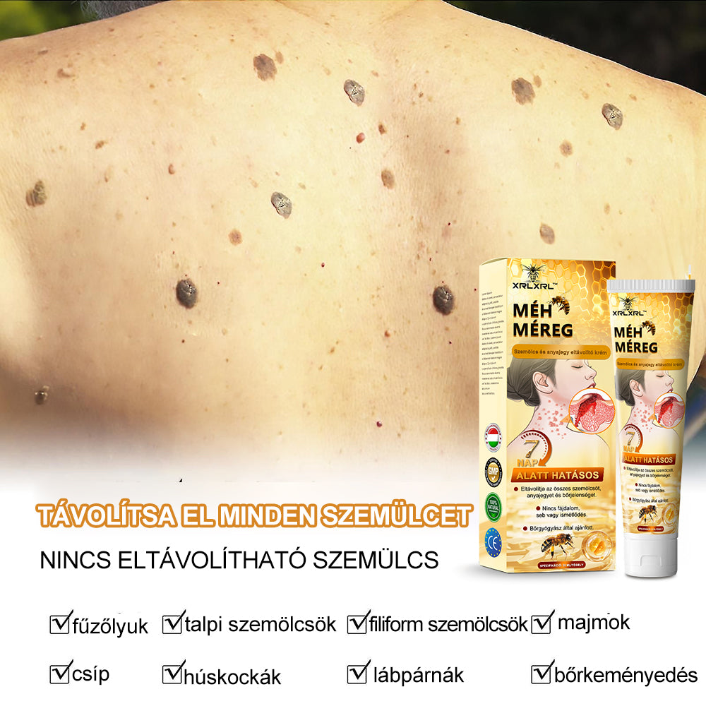 đ Csak mĂ©g 5 doboz van hĂĄtra! Extra 50% kedvezmĂ©nyt kĂnĂĄlunk Ănnek! Tartsa bĆrĂ©t egĂ©szsĂ©gesen. Most javĂtsa meg, kĂŒlönben csak jövĆre lesz rĂĄ lehetĆsĂ©g.