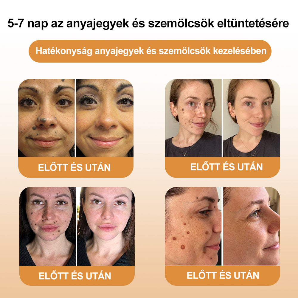 đđ GratulĂĄlunk, hogy az elsĆ 200 rendelĂ©s egyike lettĂ©l! Ălvezd az extra 50% kedvezmĂ©nyt! Cselekedj most, Ă©s Ćrizd meg bĆröd egĂ©szsĂ©gĂ©t. Ha most lemaradsz, csak jövĆre lesz Ășjabb lehetĆsĂ©g!
