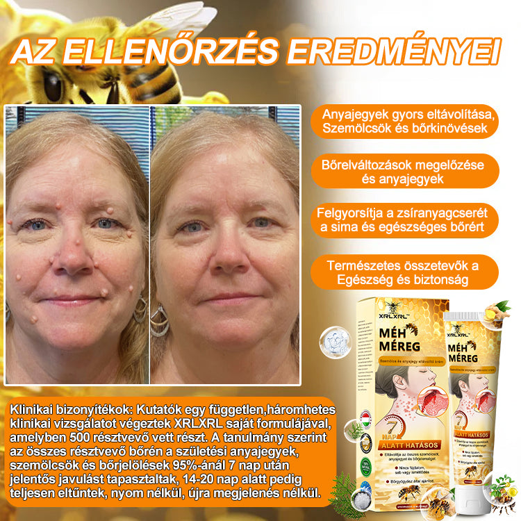 đ Csak mĂ©g 5 doboz van hĂĄtra! Extra 50% kedvezmĂ©nyt kĂnĂĄlunk Ănnek! Tartsa bĆrĂ©t egĂ©szsĂ©gesen. Most javĂtsa meg, kĂŒlönben csak jövĆre lesz rĂĄ lehetĆsĂ©g.