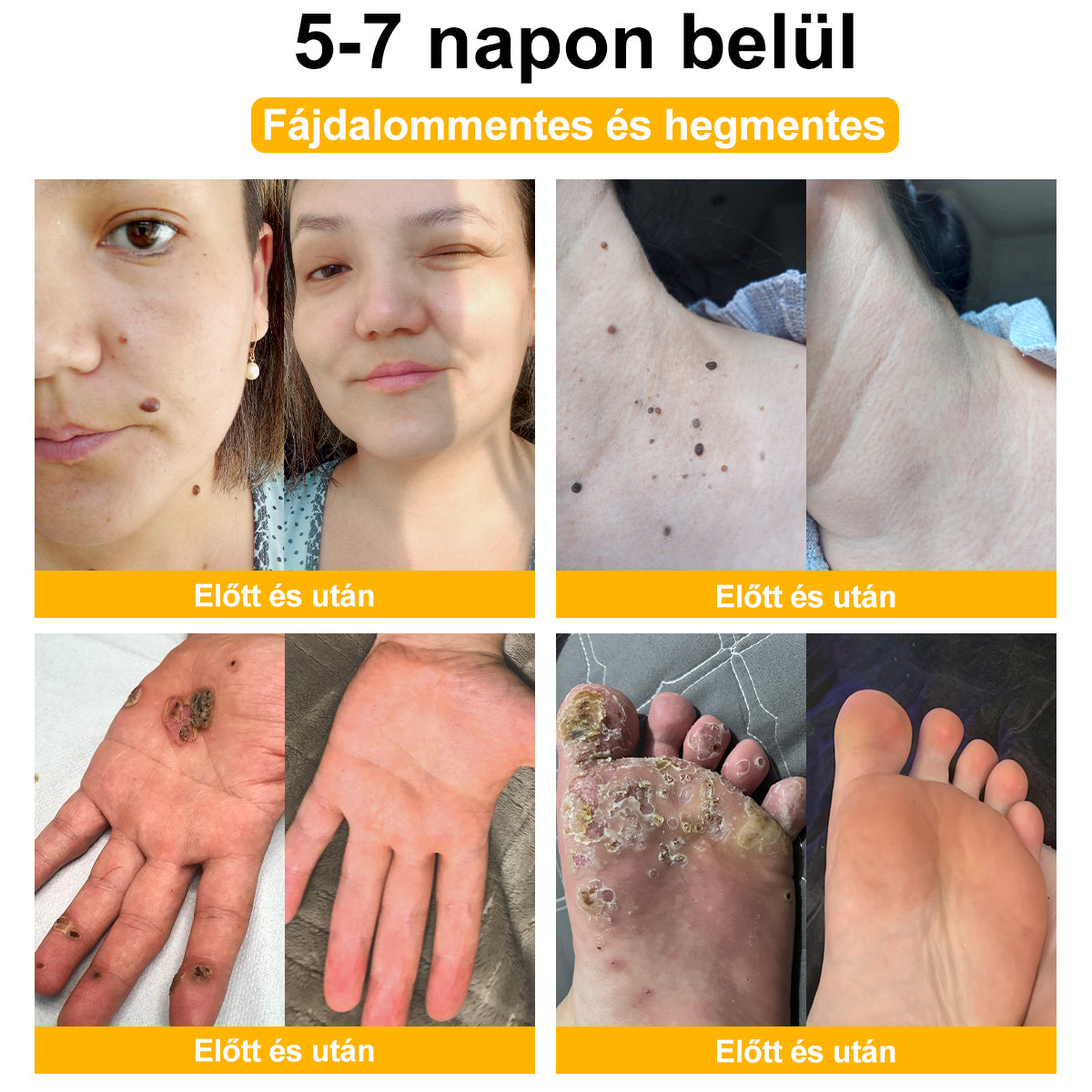 đđ GratulĂĄlunk, hogy az elsĆ 200 rendelĂ©s egyike lettĂ©l! Ălvezd az extra 50% kedvezmĂ©nyt! Cselekedj most, Ă©s Ćrizd meg bĆröd egĂ©szsĂ©gĂ©t. Ha most lemaradsz, csak jövĆre lesz Ășjabb lehetĆsĂ©g!