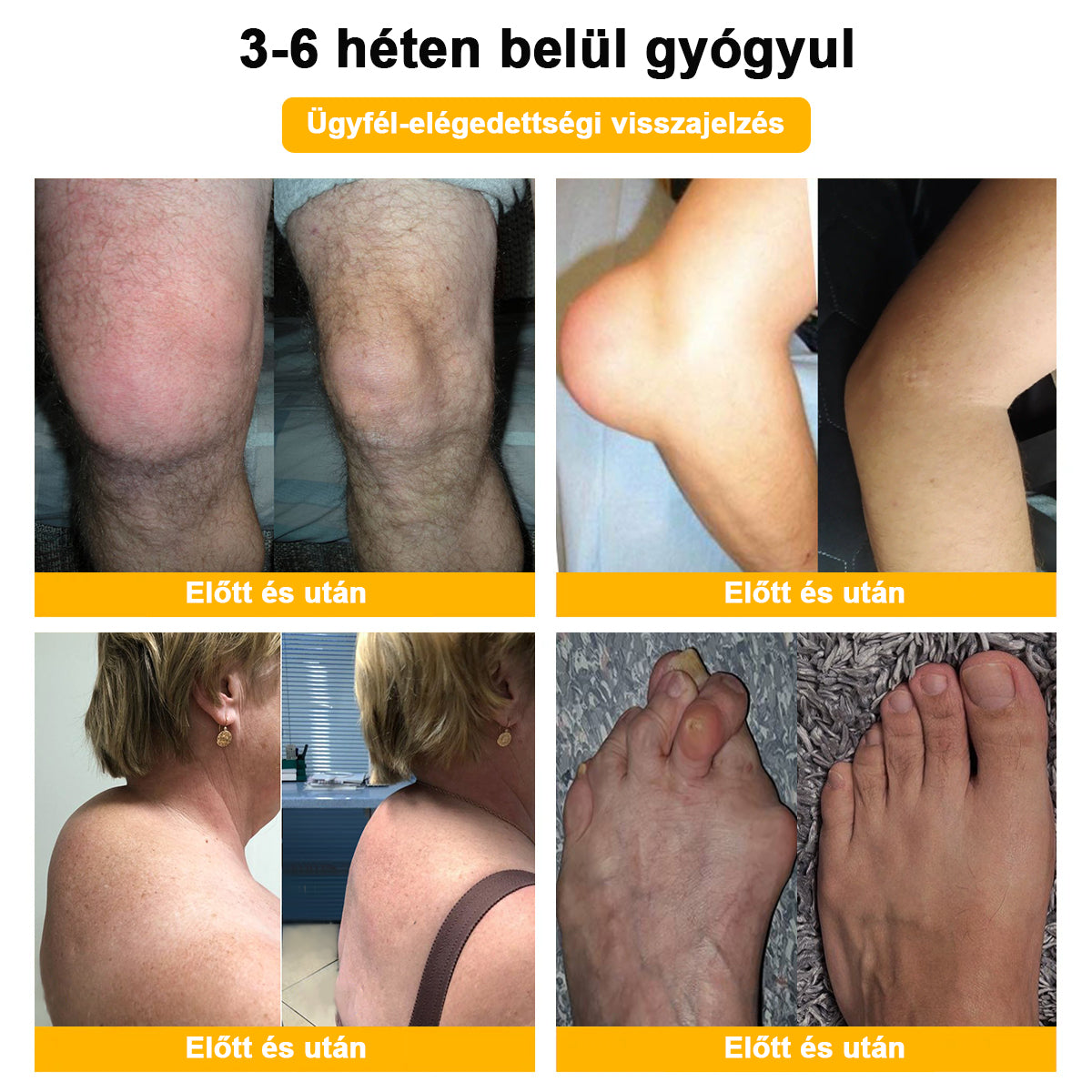 đ„đ„GratulĂĄlunk, hogy te is az elsĆ 300 rendelĂ©s egyikĂ©vĂ© vĂĄltĂĄl! Ălvezd az extra 50% kedvezmĂ©nyt! Cselekedj most, Ă©s tartsd meg ĂzĂŒleteid egĂ©szsĂ©gĂ©t. Ha most lemaradsz, csak jövĆre lesz Ășjabb lehetĆsĂ©g!