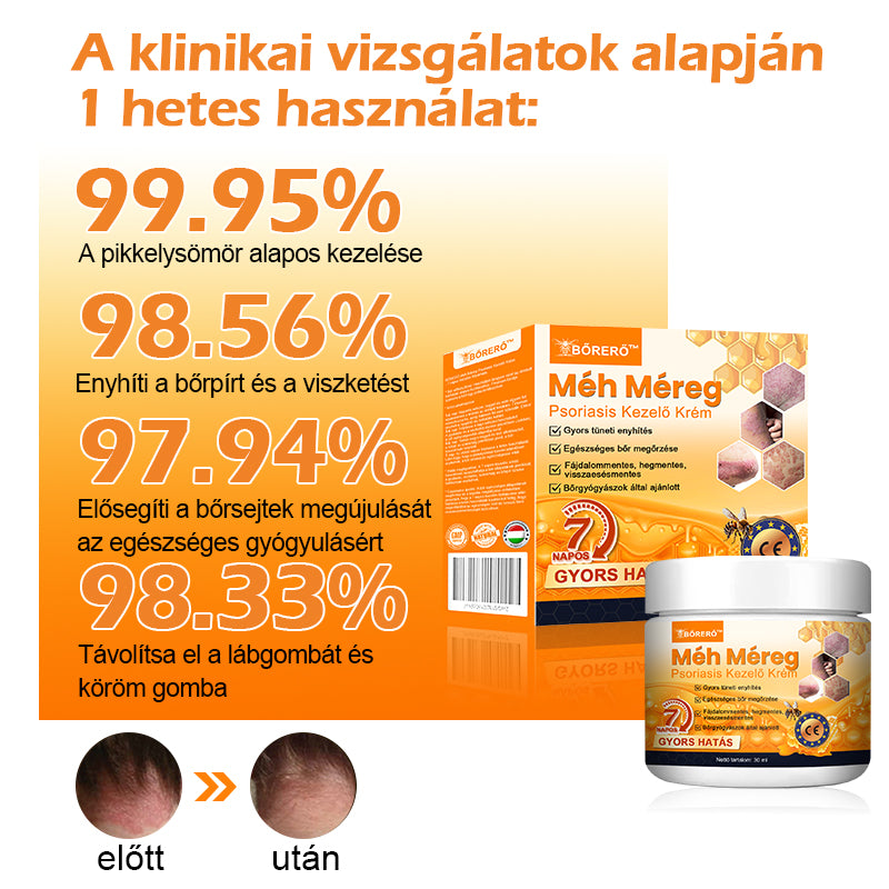 ⚜️⚜️⚜️【Hivatalos Márkabolt】BŐRERŐ™ Méh Méreg Psoriasis Kezelő Krém(⭐Pikkelysömör⭐Szemölcs⭐Körömgomba⭐)