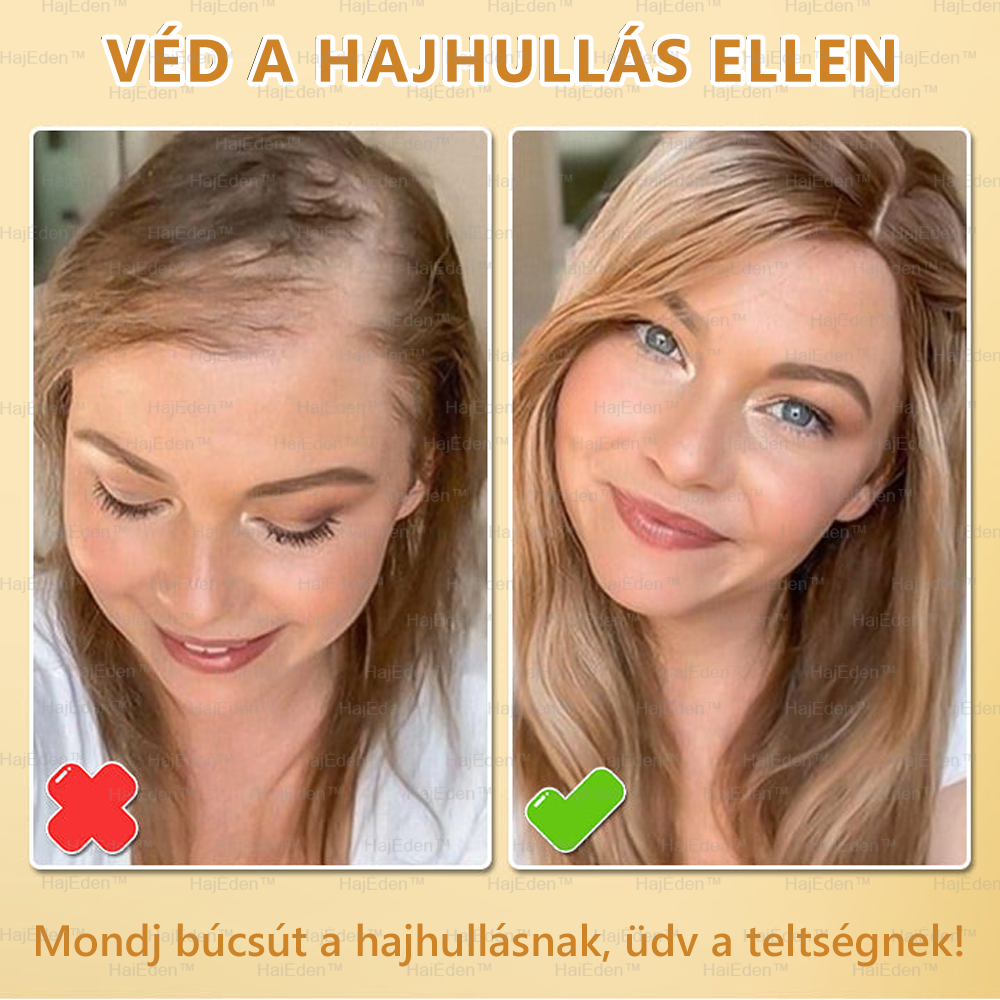 đ HajĂdenâą BIOTIN HAJNĂVEKEDĂS SZĂRUM