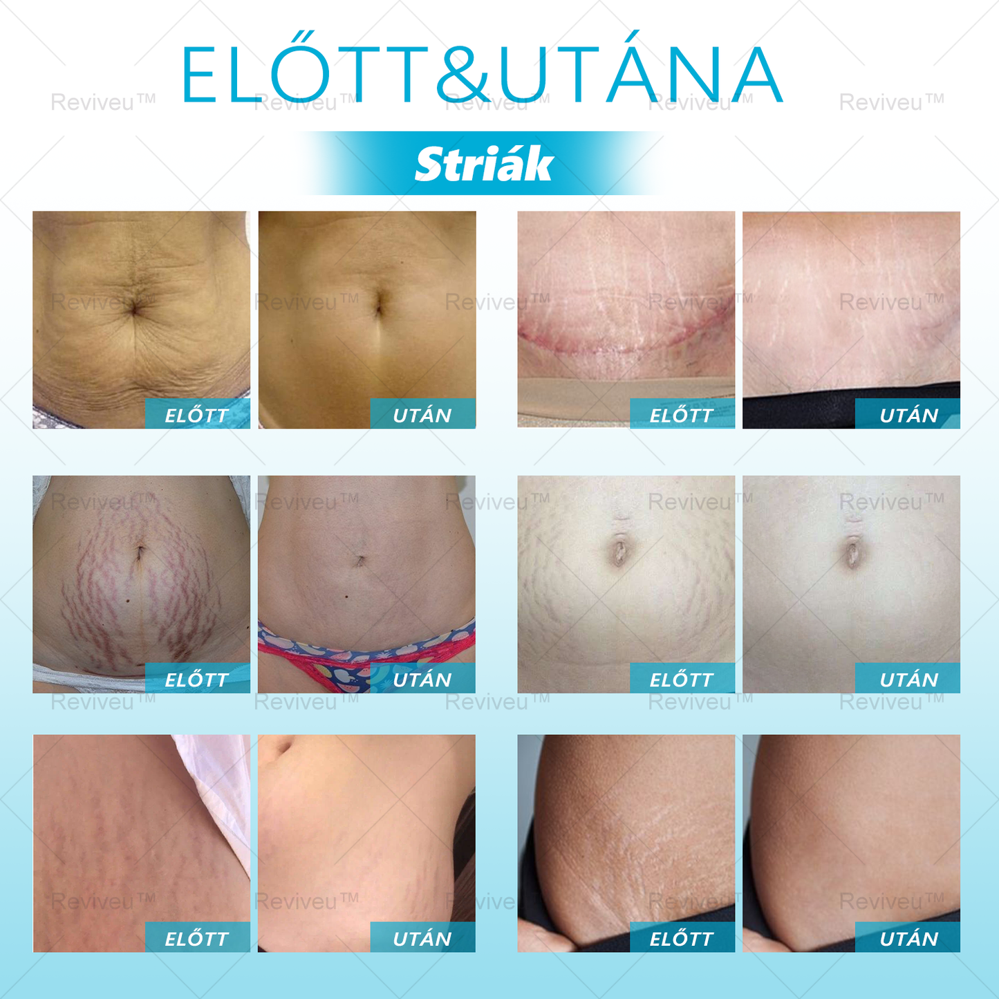 💎💎Gratulálunk, hogy te is az első 200 rendelés egyikévé váltál! Élvezd az extra 50% kedvezményt! Cselekedj most, és mutasd meg szép arcodat. Ha most lemaradsz, csak jövőre lesz újabb lehetőség!