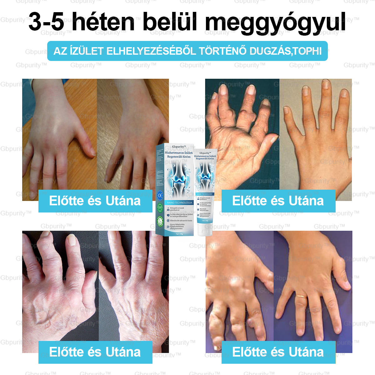🪶Gbpurity™ Hialuronsavas Ízületi Regeneráló Krém👩⚕️(Átfogó kezelés az ízületi gyulladásra, idegfájdalomra, izomfájdalomra)