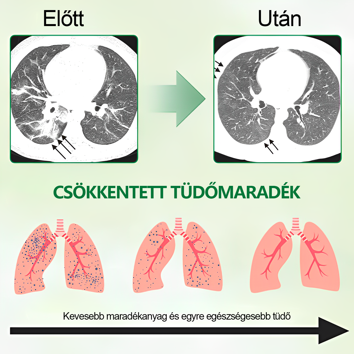 đđGratulĂĄlunk, hogy az elsĆ 200 rendelĂ©s egyike lettĂ©l! Ălvezd az extra 50% kedvezmĂ©nyt! Cselekedj most, Ă©s Ćrizd meg tĂŒdĆd egĂ©szsĂ©gĂ©t. Ha most lemaradsz, csak jövĆre lesz Ășjabb lehetĆsĂ©g!