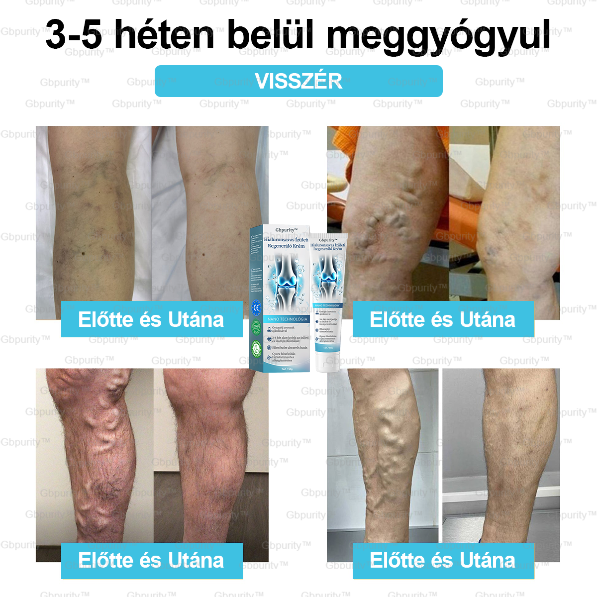 🪶Gbpurity™ Hialuronsavas Ízületi Regeneráló Krém👩⚕️(Átfogó kezelés az ízületi gyulladásra, idegfájdalomra, izomfájdalomra)