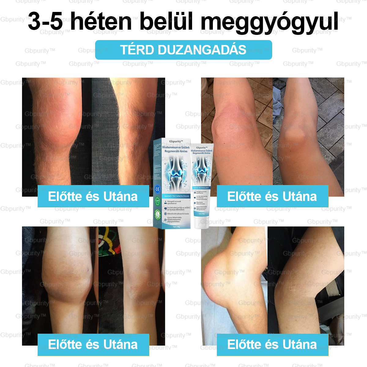 🪶Gbpurity™ Hialuronsavas Ízületi Regeneráló Krém👩⚕️(Átfogó kezelés az ízületi gyulladásra, idegfájdalomra, izomfájdalomra)