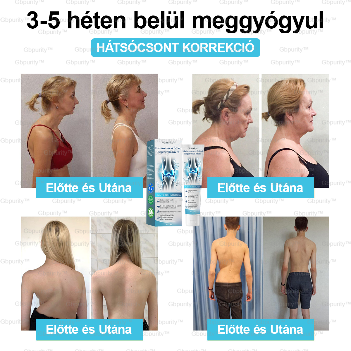 🪶Gbpurity™ Hialuronsavas Ízületi Regeneráló Krém👩⚕️(Átfogó kezelés az ízületi gyulladásra, idegfájdalomra, izomfájdalomra)