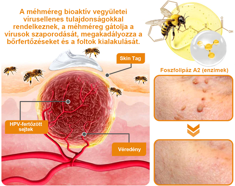 ⚜️⚜️⚜️【Hivatalos Márkabolt】BŐRERŐ™ Méh Méreg Psoriasis Kezelő Krém(⭐Pikkelysömör⭐Szemölcs⭐Körömgomba⭐)