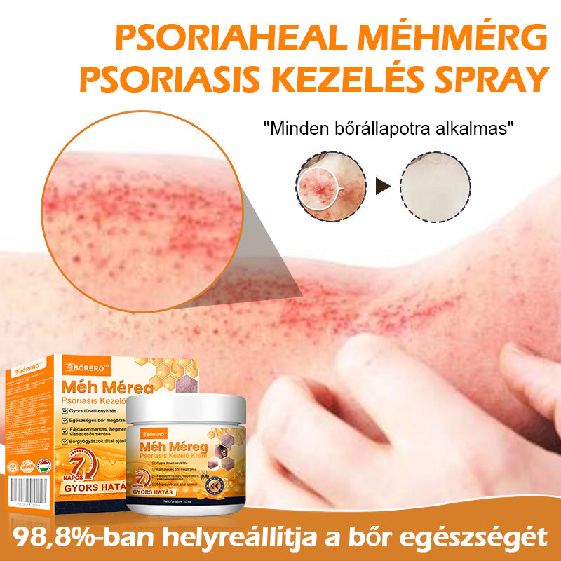 ⚜️⚜️⚜️【Hivatalos Márkabolt】BŐRERŐ™ Méh Méreg Psoriasis Kezelő Krém（⭐Pikkelysömör⭐Szemölcs⭐Körömgomba⭐）