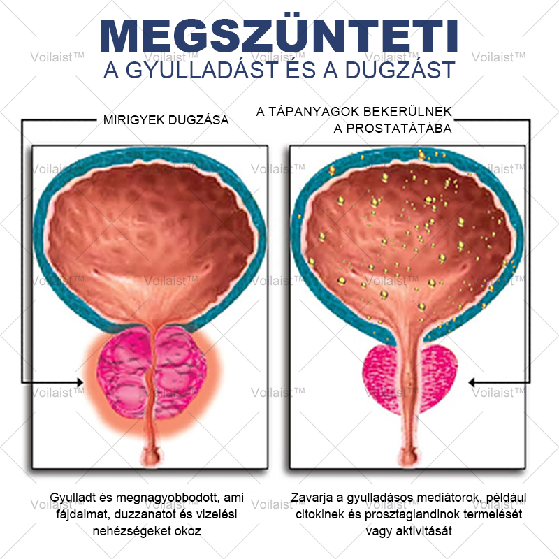 🚀🚀 Voilaist™ Szuper Méh Prostata Egészségügyi Orrspray