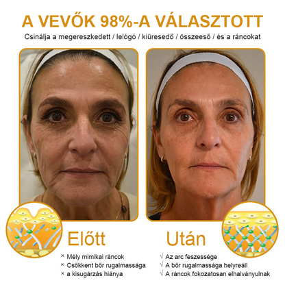 💎 FrissArc™ Botox Méhméreg Ránctalanító Krém