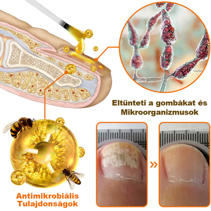 💝[✨Hivatalos Márkabolt✨] KörömVital™ Méhméreg Baktériumölő Körömkezelő Szérum